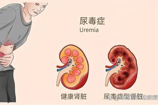 波切蒂诺：恩佐、凯塞多不是蛋糕上的樱桃，他们需要成为解决方案